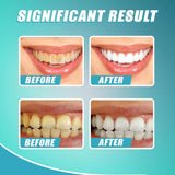 Intensive Stain Removal Whitening Toothpaste